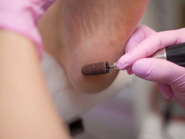 Quais as diferenças entre brocas diamantadas e fresas de tungstênio?