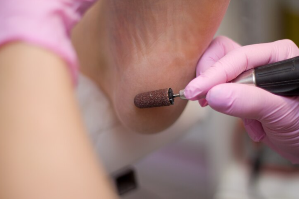 Quais as diferenças entre brocas diamantadas e fresas de tungstênio?